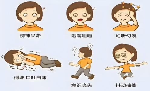 儿童癫痫的发作类型和症状